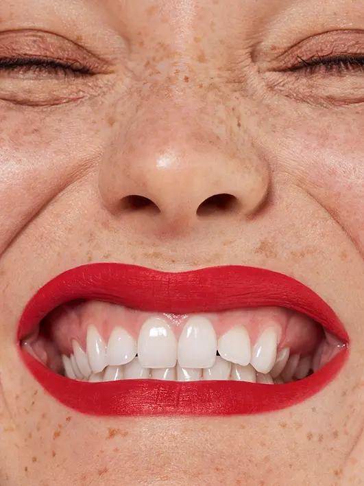 Product image 101